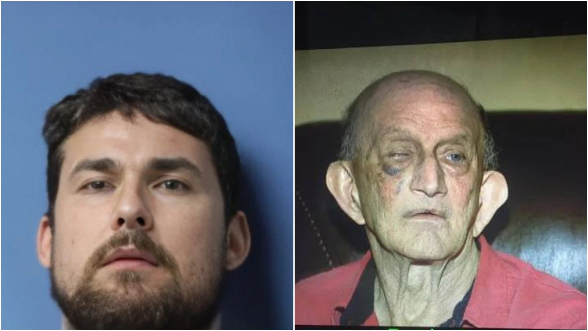 70 Year Old Man Hospitalized After Neighbor Attacks Him